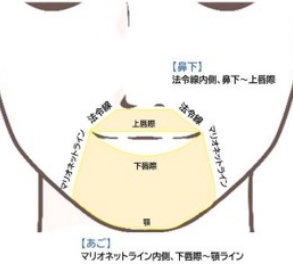 パーツ別脱毛